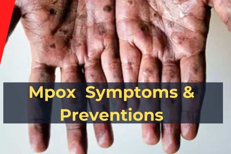 Mpox Outbreak India All You Need to Know Symptoms & Preventions